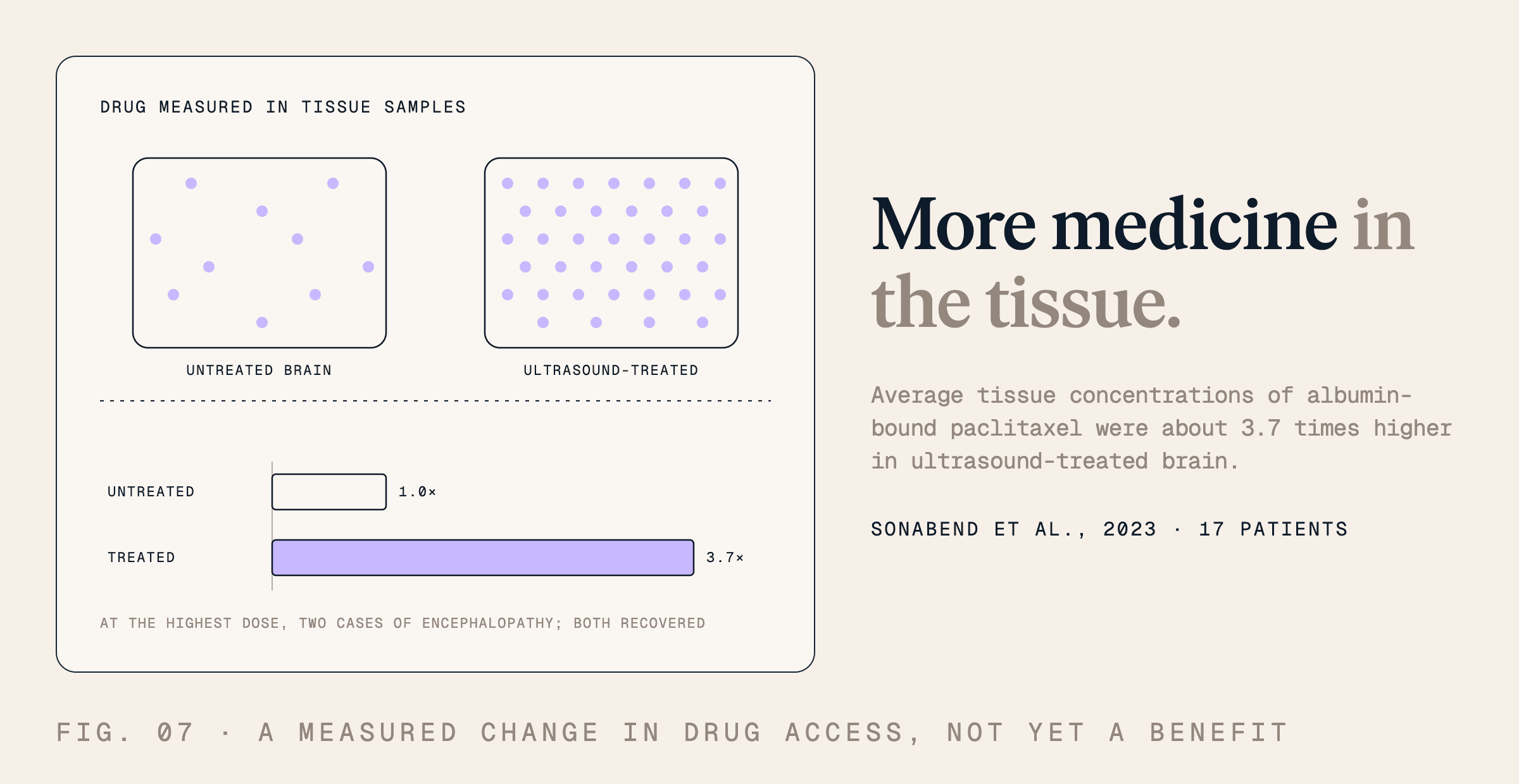 More medicine in the tissue. Average tissue concentrations of albumin-bound paclitaxel were about 3.7 times higher in ultrasound-treated brain.