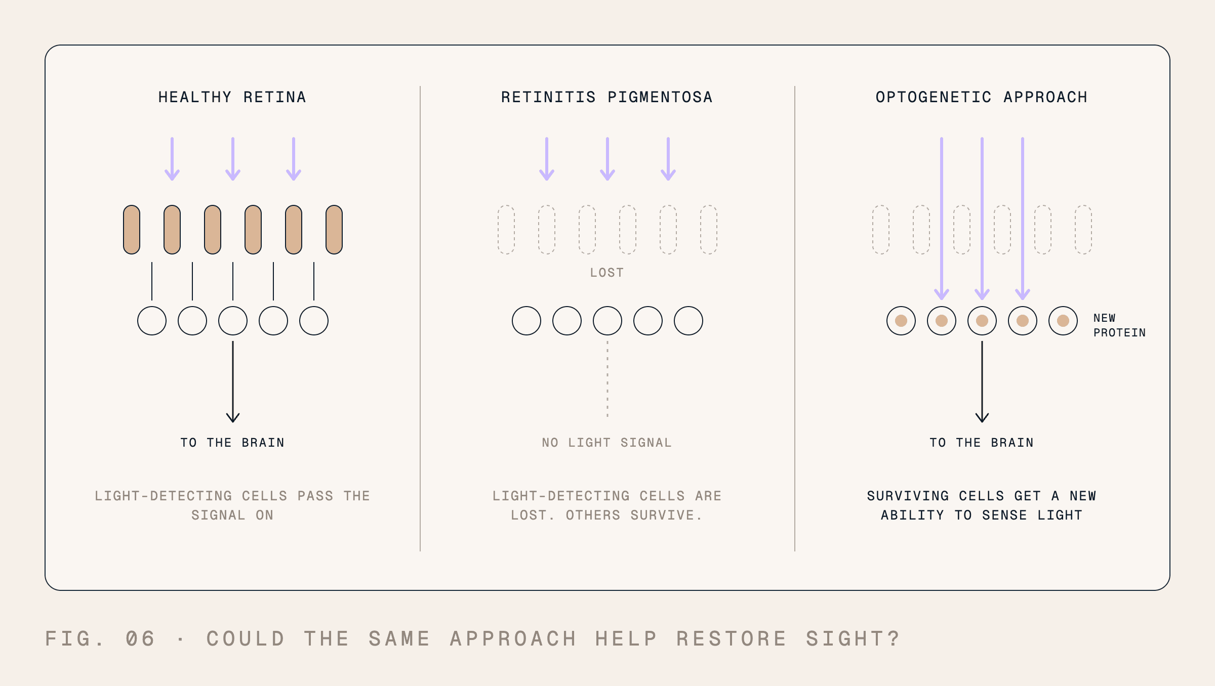 Three panels compare a healthy retina, retinitis pigmentosa, and an optogenetic approach. When light-detecting cells are lost, surviving retinal cells can receive a new light-sensitive protein, enabling them to respond to light and send signals toward the brain.