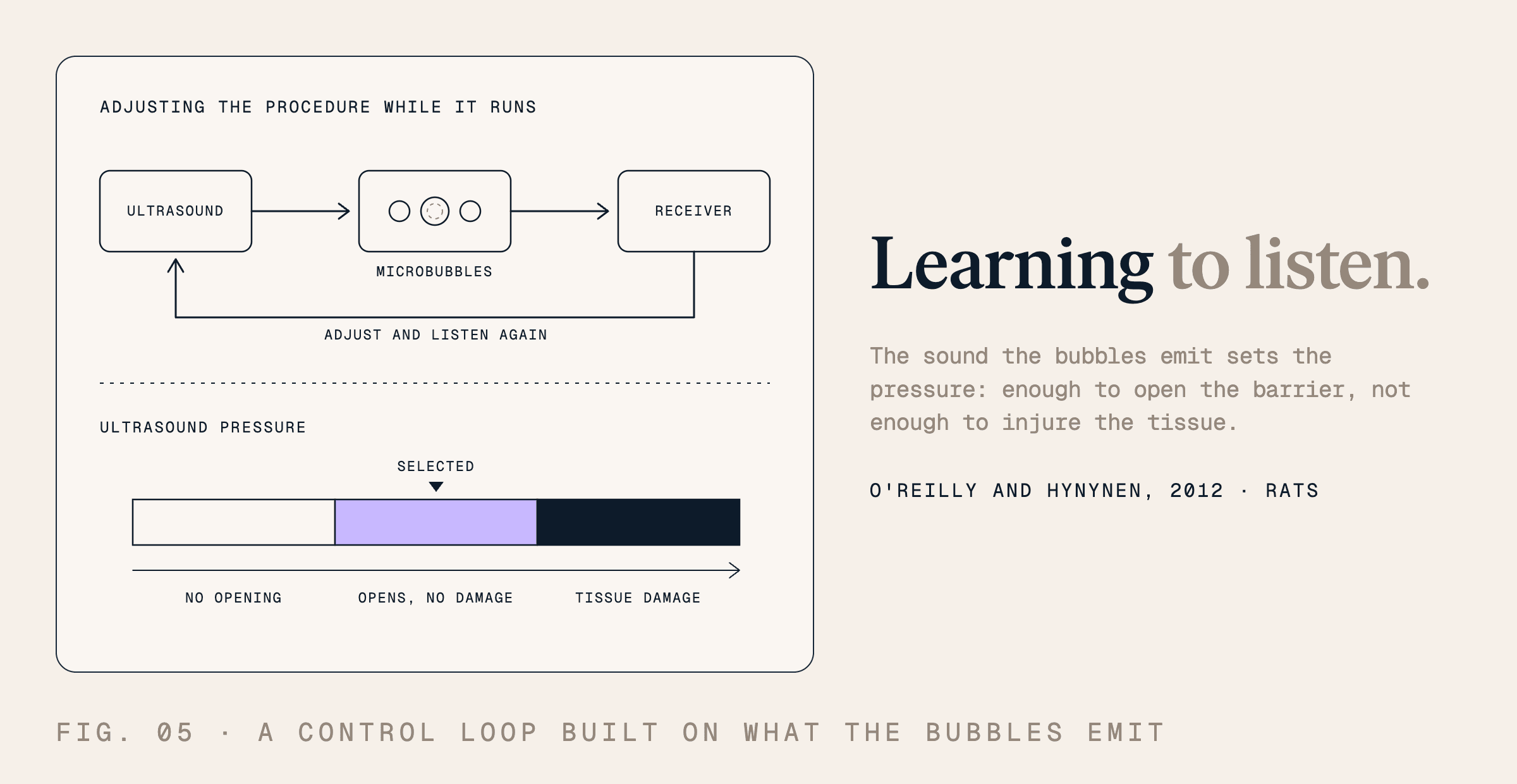 Learning to listen. The sound the bubbles emit sets the pressure: enough to open the barrier, not enough to injure the tissue.