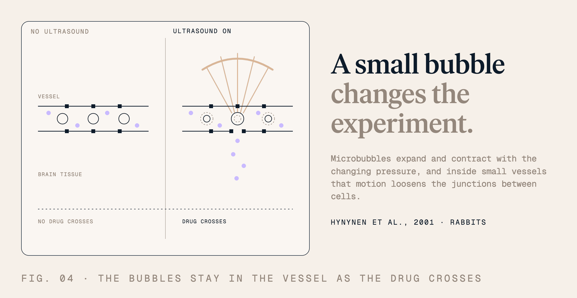 A small bubble changes the experiment. Microbubbles expand and contract with the changing pressure, and inside small vessels that motion loosens the junctions between cells.